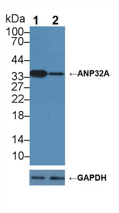 12251