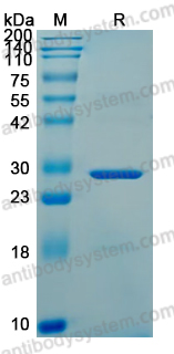 YVV17902, SDS-PAGE