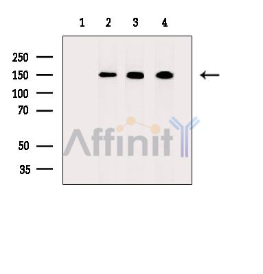 Валидация Affinity DF14845 - 10976