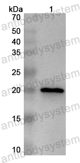 Валидация AntibodySystem PHB75001