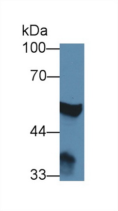 14119