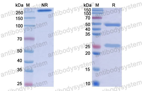 Валидация SDS-PAGE - AntibodySystem RHJ92801