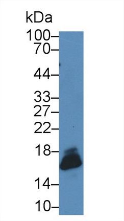 14779