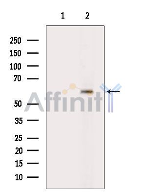 Валидация Affinity AF3953 - 2086