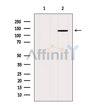 Валидация Affinity DF8425 - 20300