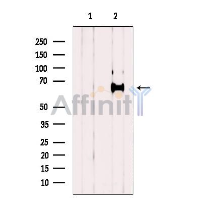 Валидация Affinity DF12403 - 6893