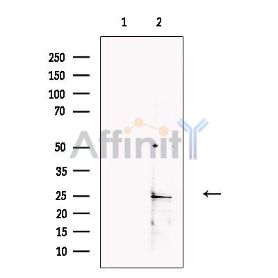 Валидация Affinity DF13739 - 9386