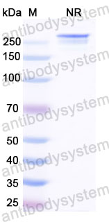 Валидация SDS-PAGE - AntibodySystem DHK07702