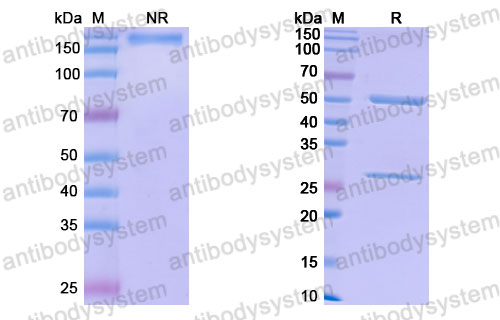 Валидация SDS-PAGE - AntibodySystem FHK17510