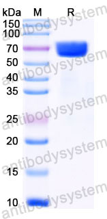 EHC31203, SDS-PAGE