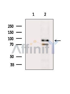 Валидация Affinity DF14899 - 11055