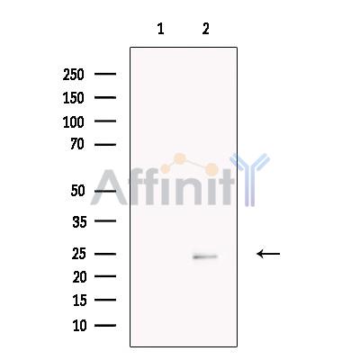 Валидация Affinity DF13646 - 9197
