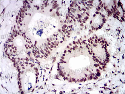Валидация AntibodySystem RHN94001 (3970)