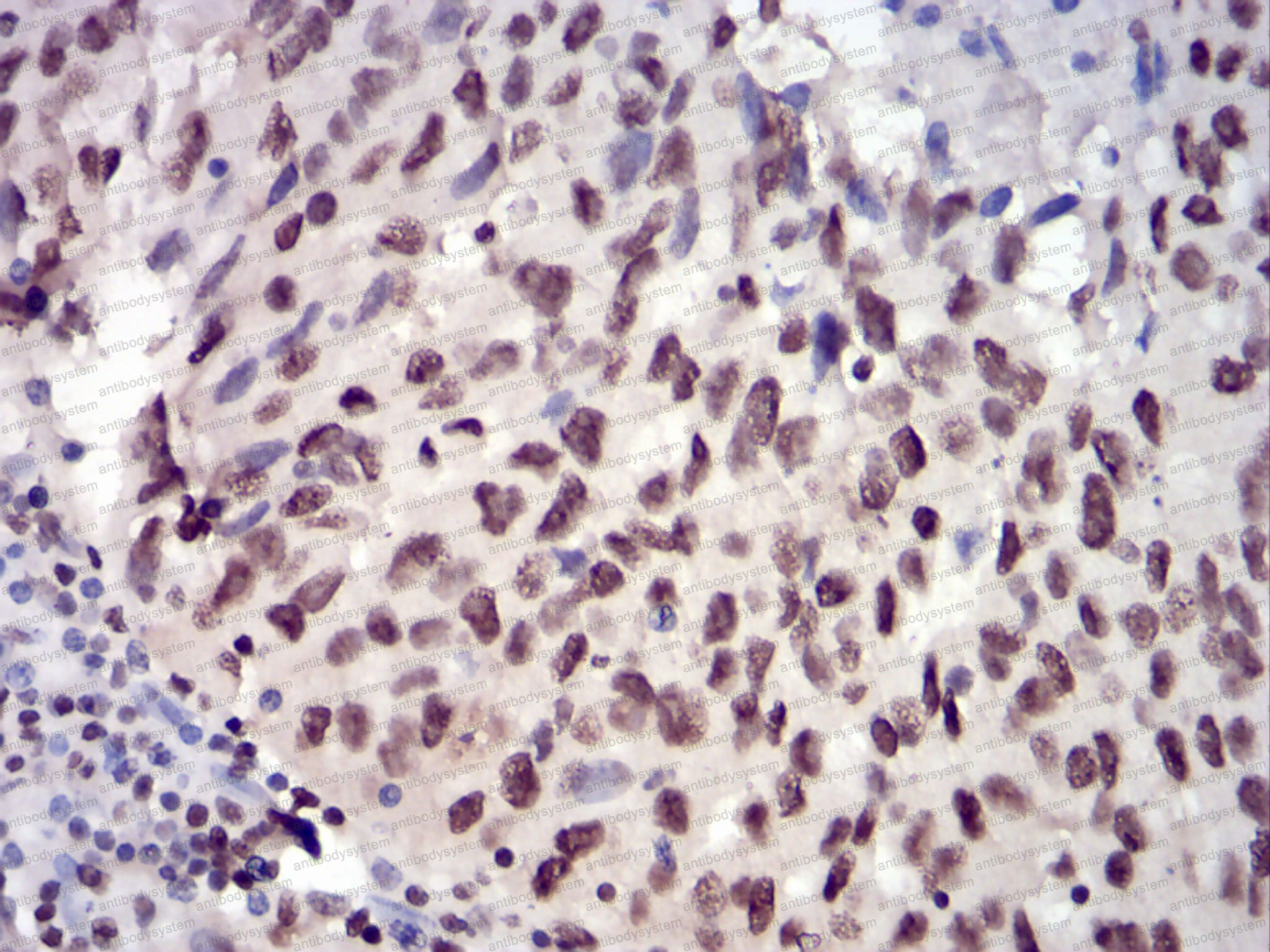 Валидация AntibodySystem RHA97302 (241)