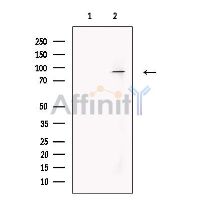Валидация Affinity DF13708 - 9323