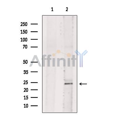 Валидация Affinity DF13578 - 9046