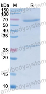 Валидация SDS-PAGE - AntibodySystem FMJ93260