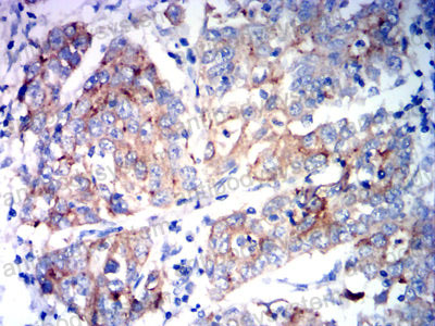 Валидация AntibodySystem RHA04202