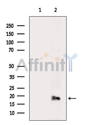 Валидация Affinity DF15310 - 11609