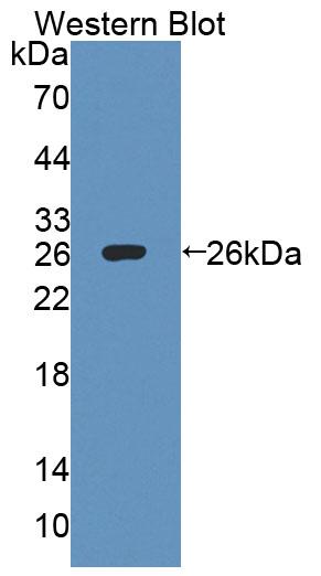 57952