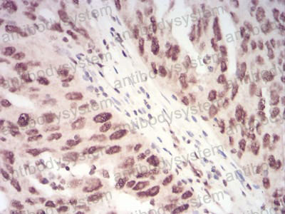 Валидация AntibodySystem RHF75404 (2654)