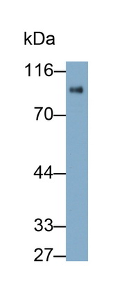 11274