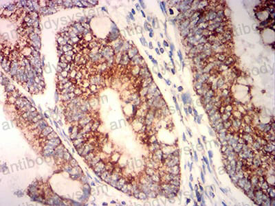 Валидация AntibodySystem RHG39702