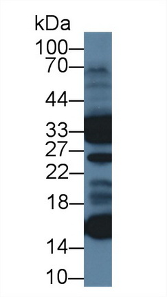 12690