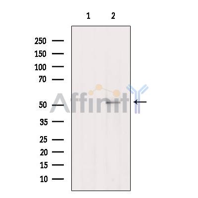 Валидация Affinity DF2603 - 13290