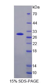 42305