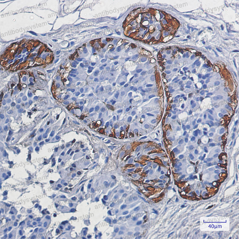 Валидация AntibodySystem RHC08402