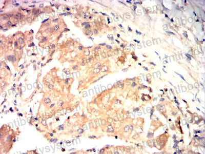 Валидация AntibodySystem RHJ71301