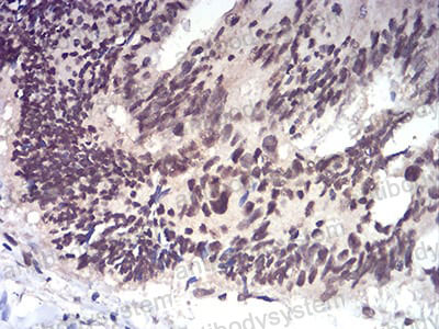 Валидация AntibodySystem RHJ34202
