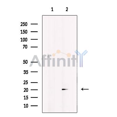 Валидация Affinity DF12407 - 6899