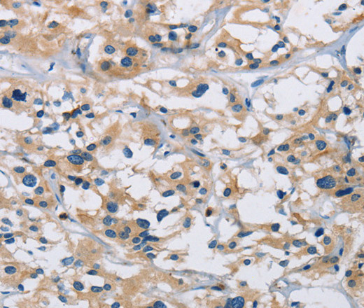 Валидация Elabscience E-AB-16512