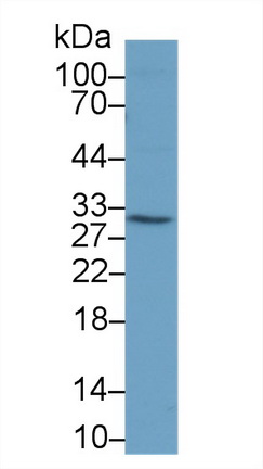 13658