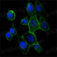 Валидация IF - AntibodySystem RHD31902
