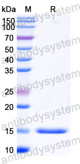 Валидация SDS-PAGE - AntibodySystem RHC08504