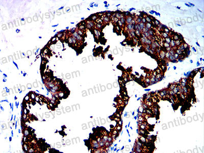 Валидация AntibodySystem RHK16101 (3627)