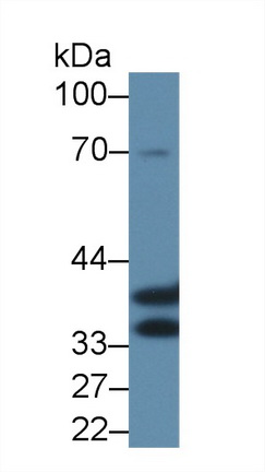 14142