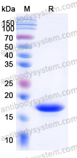 YHJ56802, SDS-PAGE