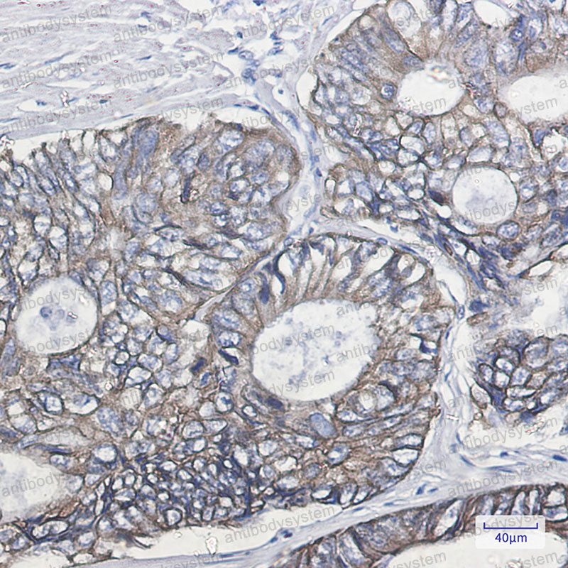 Валидация AntibodySystem RHC36003