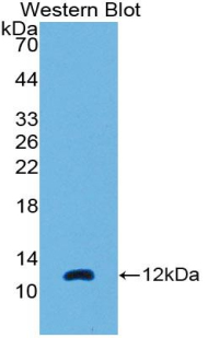 38867