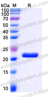 EHJ19701, SDS-PAGE