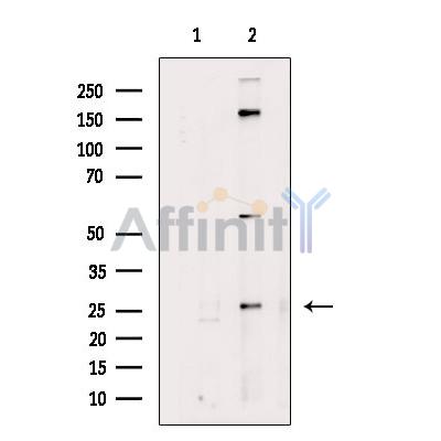 Валидация Affinity DF7408 - 19147