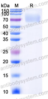 EHJ27903, SDS-PAGE