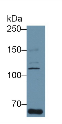 13174