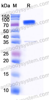 EHD96703, SDS-PAGE