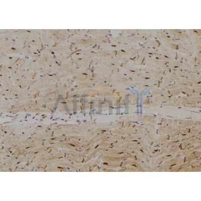 Валидация Affinity DF8866 - 20961