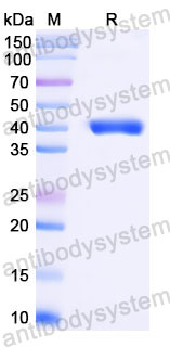 Валидация SDS-PAGE - AntibodySystem RMJ92807